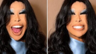 Türk sanat müziğinin unutulmaz isimlerinden Bülent Ersoy, estetik operasyon sonrası