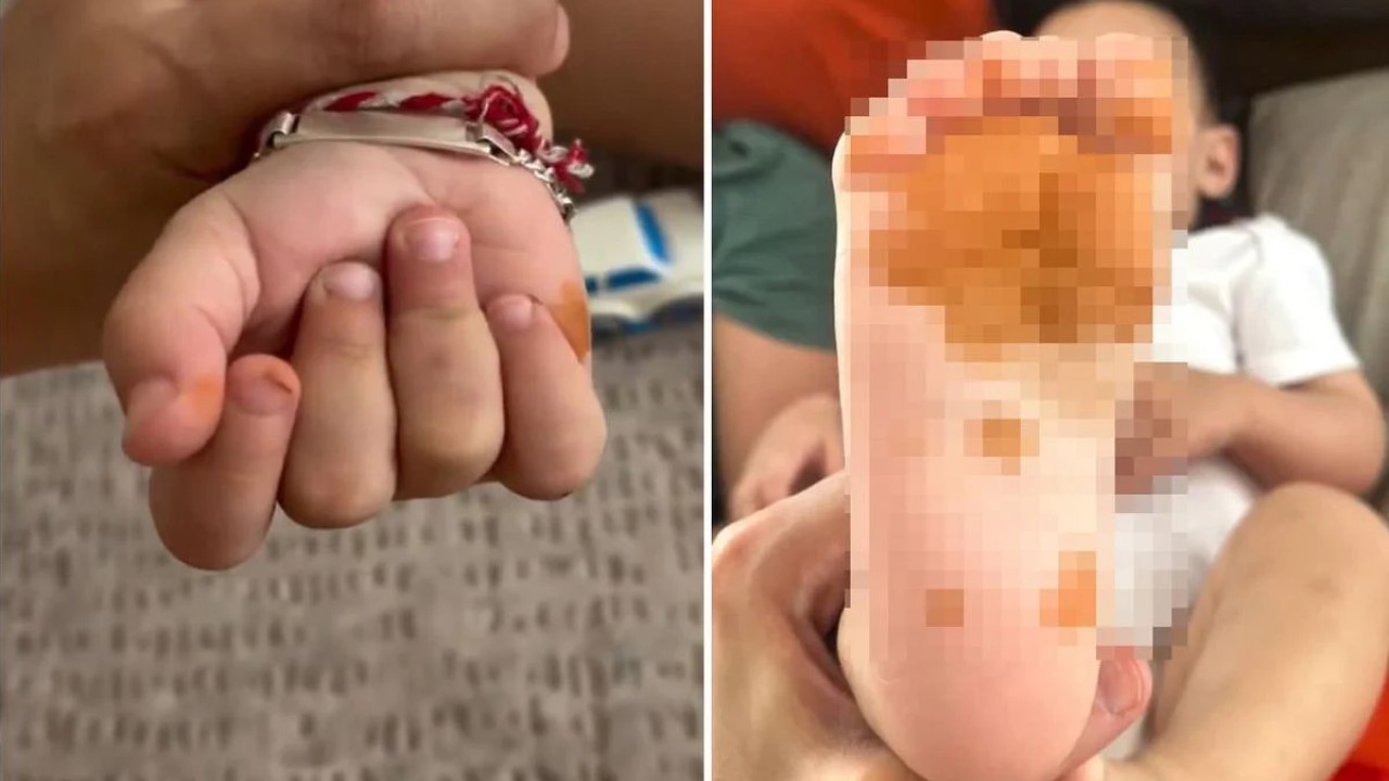 Olay Türkiye'de yaşandı! Sabah uyandığında çocuğunun eline ayağına bakan anne şoke oldu