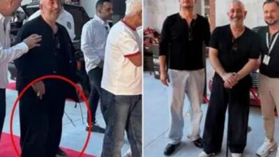 Ünlü komedyen Cem Yılmaz, son günlerde bastonla görüntülendiği haberlerin ardından