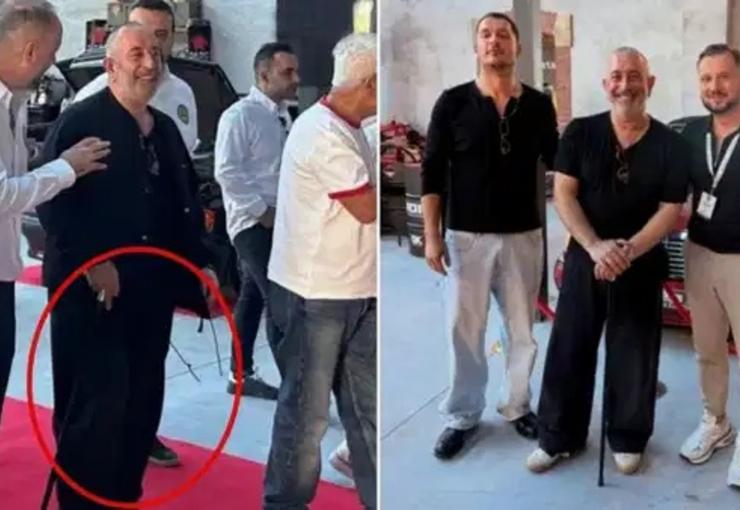 Ünlü komedyen Cem Yılmaz, son günlerde bastonla görüntülendiği haberlerin ardından